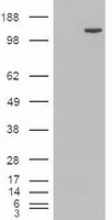 Western blot detection of Eg5 in MCF7, 293T, Jurkat and Hela cell lysates using Eg5 mouse mAb (1:1000 diluted).Predicted band size:130KDa.Observed band size:130KDa.