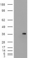 Western blot detection of NUP98 in Hela, Jurkat and MCF7 cell lysates using NUP98 mouse mAb (1:1000 diluted).Predicted band size: 98kDa.Observed band size: 98kDa.