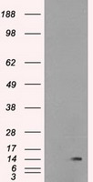 Western blot detection of Protein Phosphatase 4C in Hela and Jurkat cell lysates using Protein Phosphatase 4C mouse mAb (1:200 diluted).Predicted band size: 34KDa.Observed band size: 34KDa.