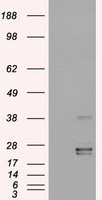 Western blot detection of DNA-PKcs in Hela, K562, HL-60 and MOLT-4 cell lysates using DNA-PKcs mouse mAb (1:1000 diluted).Predicted band size:450KDa, Observed band size:450KDa.
