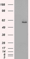Western blot detection of STAT1 in Hela, MCF7, COS7, SW480 and A549 cell lysates using STAT1 mouse mAb (1:1000 diluted).Predicted band size:91KDa.Observed band size:91KDa.