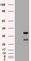 Western blot detection of Tub ulin beta in COS7, LNCap, MCF7 and C2C12 cell lysates and using Tub ulin beta mouse mAb (1:5000 diluted).Predicted band size: 55KDa.Observed band size: 55KDa.