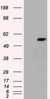 Western blot analysis of Hela (lane 1), NIH3T3 (lane 2) and Daudi (lane 3) cells using anti-Alix antibody (3A9). GAPDH antibody (poly6314) was used as loading control.