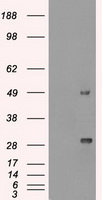 HEK293T cells were transfected with the pCMV6-ENTRY control (Cat# PS100001, Left lane) or pCMV6-ENTRY MKI67 fragment (N- and C-terminus) (Cat# RC220910, Right lane) cDNA for 48 hrs and lysed. Equivalent amounts of cell lysates (5 ug per lane) were separated by SDS-PAGE and immunoblotted with anti-MKI67 (Cat# TA500265).