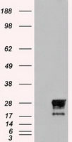 Western blot analysis of Beta-Actin in 293, A431, A549, Daudi, HeLa, HepG2, Jurkat, K562, MOLT, 3T3, Raji, Ramos, THP-1, U937, human brain, mouse brain, rat brain, rabbit brain, mouse lung, rat lung, rat liver, rabbit liver, rabbit spleen, chicken liver, chicken small intestine, zebrafish, and drosophila lysate with beta-Actin antibody at 1 ug/mL.