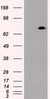 HEK293T cells were transfected with the pCMV6-ENTRY control (Left lane) or pCMV6-ENTRY PROM2 (RC211605, Right lane) cDNA for 48 hrs and lysed. Equivalent amounts of cell lysates (5 ug per lane) were separated by SDS-PAGE and immunoblotted with anti-PROM2. Positive lysates LY403405 (100ug) and LC403405 (20ug) can be purchased separately from OriGene.