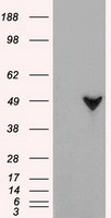 The A431 cell lysate (40 ug) were resolved by SDS-PAGE, transferred to PVDF membrane and probed with anti-human ATGL antibody (1:1000). Proteins were visualized using a goat anti-mouse secondary antibody conj ugated to HRP and an ECL detection system.