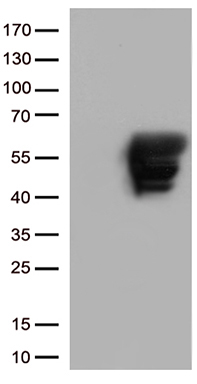 Figure 1. Expi 293 cell line transfected with irrelevant protein (left) and human CS1 (right) were surface stained with Rabbit anti-CS1monoclonal antibody 1 ug/ml (clone: DM9) followed by Alexa 488-conj ugated anti-rabbit IgG secondary antibody.