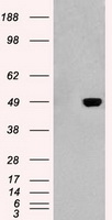 Figure 1. Competition flow cytometry assay demonstrating Rabbit anti-RBD monoclonal antibody (clone: DM26) blockade of SARS-CoV-2 (COVID-19) S protein RBD (1 ug/ml, TP724025) binding to Expi 293 cell line transfected with human ACE2. IC50=1717ng/ml. The Y-axis represents the geometric mean fluorescence intensity (MFI) while the X-axis represents the concentration of IgG used.