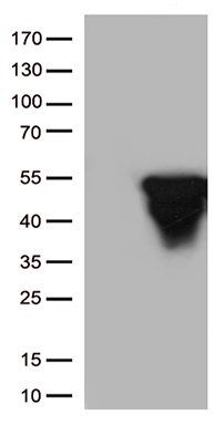 Figure 1. Elisa plate pre-coated by 2 ug/ml (100 ul/well) SARS-CoV-2 RBD protein can bind Rabbit Anti-SARS-CoV-2 RBD monoclonal antibody (clone:DM35) in a linear range of 0.19-200 ng/ml.