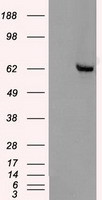 Human osteoclastoma: immunohistochemical staining for Tartrate-Resistant Acid Phosphatase. Tartrate-Resistant Acid Phosphatase (TRAP): clone 26E5
