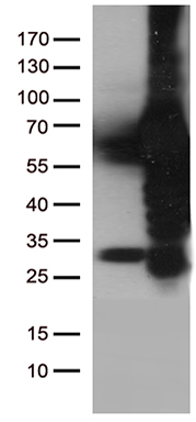 TA363841, Clone ER-BMDM1, mouse spleen, frozen section