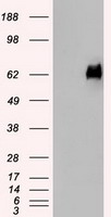 Western Blot of porcine plasma and poCRP with monoclonal antibody PC1. Porcine plasma was diluted 1/25 and spiked with 0.08 or 0.3 ug purified porcine CRP, respec- tively. PAGE was performed under reducing and denaturing conditions (10-20% gel), blotted (nitrocell ulose) and developed with antibody PC1 (left) or competitor's monoclonal antibody (right). Lane A: plasma spiked with 0.08 ug poCRP; lane B: 0.08 ug poCRP; lane C: plasma spiked with 0.3 ug poCRP; lane D: plasma; lane E: 0.3 ug poCRP. Antibody PC1 barely reacts with the 50-55kDa bands visible on the right, presumably immunoglob ulin heavy chains. Gel was slightly overloaded to allow visibility of CRP band in plasma. ©BMA Biomedicals