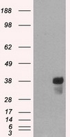 HT29 cells are fixed with 2% formaldehyde for 20 min at RT, then stained with DyLight 488-labeled 2A2 anti-Lgr5 antibody. Black line: isotope control; Red line: anti-Lgr5-DyLight 488.