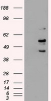 HEK293T cells transfected with either RC202822 overexpress plasmid (right) or empty vector control plasmid (left) were fixed with 2% PFA and permeabilized with 0.1% saponin before stained with TA400029.