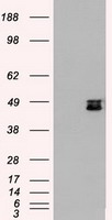 HEK293T cells were transfected with the pCMV6-ENTRY control (Left lane) or pCMV6-ENTRY MAP2K4 (RC206051, Right lane) cDNA for 48 hrs and lysed. Equivalent amounts of cell lysates (5 ug per lane) were separated by SDS-PAGE and immunoblotted with anti-MAP2K4 (TA500411). Positive lysates LY401058 (100ug) and LC401058 (20ug) can be purchased separately from OriGene.