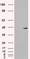 HEK293T cells were transfected with the pCMV6-ENTRY control (Left lane) or pCMV6-ENTRY MAP2K4 (RC206051, Right lane) cDNA for 48 hrs and lysed. Equivalent amounts of cell lysates (5 ug per lane) were separated by SDS-PAGE and immunoblotted with anti-MAP2K4. Positive lysates LY401058 (100ug) and LC401058 (20ug) can be purchased separately from OriGene.
