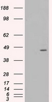 HEK293T cells were transfected with the pCMV6-ENTRY control (Left lane) or pCMV6-ENTRY MAP2K4 (RC206051, Right lane) cDNA for 48 hrs and lysed. Equivalent amounts of cell lysates (5 ug per lane) were separated by SDS-PAGE and immunoblotted with anti-MAP2K4. Positive lysates LY401058 (100ug) and LC401058 (20ug) can be purchased separately from OriGene.