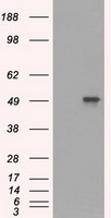 HEK293T cells were transfected with the pCMV6-ENTRY control (Left lane) or pCMV6-ENTRY SOX17 (RC220888, Right lane) cDNA for 48 hrs and lysed. Equivalent amounts of cell lysates (5 ug per lane) were separated by SDS-PAGE and immunoblotted with anti-SOX17. Positive lysates LY411669 (100 ug) and LC411669 (20 ug) can be purchased separately from OriGene.