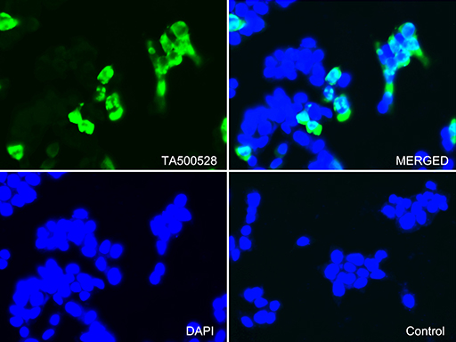 /assets/images/antibody/100/ta500528-1-f.jpg