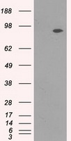 HEK293T cells were transfected with the pCMV6-ENTRY control (Left lane) or pCMV6-ENTRY NEUROG1 (RC207029, Right lane) cDNA for 48 hrs and lysed. Equivalent amounts of cell lysates (5 ug per lane) were separated by SDS-PAGE and immunoblotted with anti-NEUROG1. Positive lysates LY401855 (100 ug) and LC401855 (20 ug) can be purchased separately from OriGene.