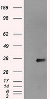 Anti-GAD1 mouse monoclonal antibody (TA500328) immunofluorescent staining of COS7 cells transiently transfected by pCMV6-ENTRY GAD1 (RC207226).
