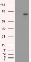 HEK293T cells were transfected with the pCMV6-ENTRY control (Left lane) or pCMV6-ENTRY GAD1 (RC207226, Right lane) cDNA for 48 hrs and lysed. Equivalent amounts of cell lysates (5 ug per lane) were separated by SDS-PAGE and immunoblotted with anti-GAD1. Positive lysates LY400290 (100 ug) and LC400290 (20 ug) can be purchased separately from OriGene.