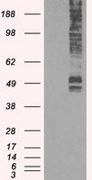 HEK293T cells were transfected with the pCMV6-ENTRY control (Left lane) or pCMV6-ENTRY L1CAM (RC211601, Right lane) cDNA for 48 hrs and lysed. Equivalent amounts of cell lysates (5 ug per lane) were separated by SDS-PAGE and immunoblotted with anti-L1CAM. Positive lysates LY400150 (100 ug) and LC400150 (20 ug) can be purchased separately from OriGene.