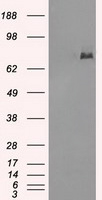 HEK293T cells were transfected with the pCMV6-ENTRY control (Left lane) or pCMV6-ENTRY USP13 (RC202190, Right lane) cDNA for 48 hrs and lysed. Equivalent amounts of cell lysates (5 ug per lane) were separated by SDS-PAGE and immunoblotted with anti-USP13. Positive lysates LY401292 (100 ug) and LC401292 (20 ug) can be purchased separately from OriGene.
