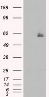 HEK293T cells were transfected with the pCMV6-ENTRY control (Left lane) or pCMV6-ENTRY CHEK2 (RC201278, Right lane) cDNA for 48 hrs and lysed. Equivalent amounts of cell lysates (5 ug per lane) were separated by SDS-PAGE and immunoblotted with anti-CHEK2. Positive lysates LY416128 (100 ug) and LC416128 (20 ug) can be purchased separately from OriGene.