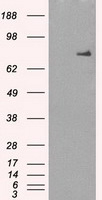HEK293T cells were transfected with the pCMV6-ENTRY control (Left lane) or pCMV6-ENTRY CHEK2 (RC201278, Right lane) cDNA for 48 hrs and lysed. Equivalent amounts of cell lysates (5 ug per lane) were separated by SDS-PAGE and immunoblotted with anti-CHEK2. Positive lysates LY416128 (100 ug) and LC416128 (20 ug) can be purchased separately from OriGene.