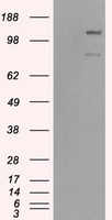HEK293T cells were transfected with the pCMV6-ENTRY control (Left lane) or pCMV6-ENTRY PLK1 (RC201795, Right lane) cDNA for 48 hrs and lysed. Equivalent amounts of cell lysates (5 ug per lane) were separated by SDS-PAGE and immunoblotted with anti-PLK1. (1:. Positive lysates LY417592 (100 ug) and LC417592 (20 ug) can be purchased separately from OriGene.