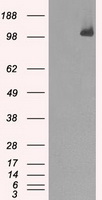 Equivalent amounts of cell lysates (10 ug per lane) of wild-type HeLa cells (WT, Cat# LC810HELA) and CHEK2-Knockout hela cells (KO, Cat# LC810324) were separated by SDS-PAGE and immunoblotted with anti-CHEK2 monoclonal antibody TA500398. Then the blotted membrane was stripped and reprobed with anti-β-actin (TA811000) as a loading control (1:500).