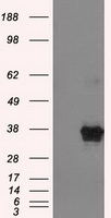 Western blot analysis of extracts from HUVEC cells, treated with PMA (125ng/ml, 30mins), using APC (Phospho-Ser2054) antibody.The lane on the right is treated with the synthesized peptide.