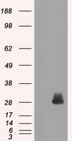 HEK293T cells were transfected with the pCMV6-ENTRY control (Left lane) or pCMV6-ENTRY TYRO3 (RC208260, Right lane) cDNA for 48 hrs and lysed. Equivalent amounts of cell lysates (5 ug per lane) were separated by SDS-PAGE and immunoblotted with anti-TYRO3. Positive lysates LY401899 (100 ug) and LC401899 (20 ug) can be purchased separately from OriGene.