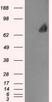 HEK293T cells were transfected with the pCMV6-ENTRY control (Left lane) or pCMV6-ENTRY SSB (RC205013, Right lane) cDNA for 48 hrs and lysed. Equivalent amounts of cell lysates (5 ug per lane) were separated by SDS-PAGE and immunoblotted with anti-SSB. Positive lysates LY401091 (100 ug) and LC401091 (20 ug) can be purchased separately from OriGene.