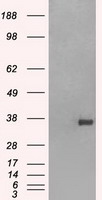 HEK293T cells were transfected with the pCMV6-ENTRY control (Left lane) or pCMV6-ENTRY SSB (RC205013, Right lane) cDNA for 48 hrs and lysed. Equivalent amounts of cell lysates (5 ug per lane) were separated by SDS-PAGE and immunoblotted with anti-SSB. Positive lysates LY401091 (100 ug) and LC401091 (20 ug) can be purchased separately from OriGene.