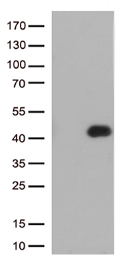/assets/images/antibody/100/ta500646-1-w.jpg