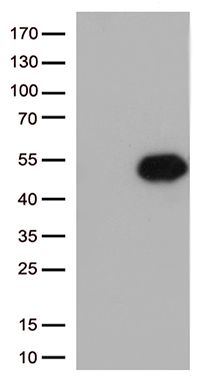 /assets/images/antibody/100/ta500649-1-w.jpg