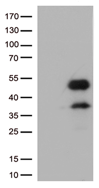 /assets/images/antibody/100/ta500651-1-w.jpg