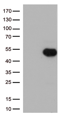 /assets/images/antibody/100/ta500652-1-w.jpg