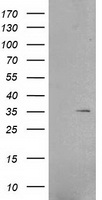 HEK293T cells were transfected with the pCMV6-ENTRY control (Left lane) or pCMV6-ENTRY FERMT2 (RC205727, Right lane) cDNA for 48 hrs and lysed. Equivalent amounts of cell lysates (5 ug per lane) were separated by SDS-PAGE and immunoblotted with anti-FERMT2. Positive lysates LY416377 (100 ug) and LC416377 (20 ug) can be purchased separately from OriGene.