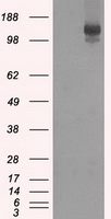 HEK293T cells were transfected with the pCMV6-ENTRY control (Left lane) or pCMV6-ENTRY NEK6 (RC203609, Right lane) cDNA for 48 hrs and lysed. Equivalent amounts of cell lysates (5 ug per lane) were separated by SDS-PAGE and immunoblotted with anti-NEK6. Positive lysates LY402327 (100 ug) and LC402327 (20 ug) can be purchased separately from OriGene.