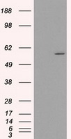 HEK293T cells were transfected with the pCMV6-ENTRY control (Left lane) or pCMV6-ENTRY CTAG1B (RC213318, Right lane) cDNA for 48 hrs and lysed. Equivalent amounts of cell lysates (5 ug per lane) were separated by SDS-PAGE and immunoblotted with anti-CTAG1B. Positive lysates LY400527 (100 ug) and LC400527 (20 ug) can be purchased separately from OriGene.