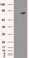 HEK293T cells were transfected with the pCMV6-ENTRY control (Left lane) or pCMV6-ENTRY CRYAB (RC202718, Right lane) cDNA for 48 hrs and lysed. Equivalent amounts of cell lysates (5 ug per lane) were separated by SDS-PAGE and immunoblotted with anti-CRYAB. Positive lysates LY419682 (100 ug) and LC419682 (20 ug) can be purchased separately from OriGene.