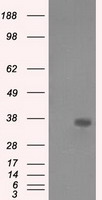 Anti-CRYAB mouse monoclonal antibody (TA500590) immunofluorescent staining of COS7 cells transiently transfected by pCMV6-ENTRY CRYAB (RC202718).