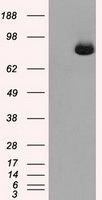 HEK293T cells were transfected with the pCMV6-ENTRY control (Left lane) or pCMV6-ENTRY SLC2A5 (RC200418, Right lane) cDNA for 48 hrs and lysed. Equivalent amounts of cell lysates (5 ug per lane) were separated by SDS-PAGE and immunoblotted with anti-SLC2A5. Positive lysates LY401061 (100 ug) and LC401061 (20 ug) can be purchased separately from OriGene.