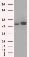 Anti-SLC7A8 mouse monoclonal antibody (TA500632) immunofluorescent staining of COS7 cells transiently transfected by pCMV6-ENTRY SLC7A8 (RC208586).