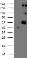 Western blot analysis of extracts from Jurkat cells, using SEPT1 antibody.The lane on the right is treated with the synthesized peptide.