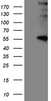 Western blot analysis of extracts from Jurkat cells and COLO205 cells, using DMPK antibody.The lane on the right is treated with the synthesized peptide.